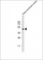 HIS Tag Antibody, HRP Conjugate